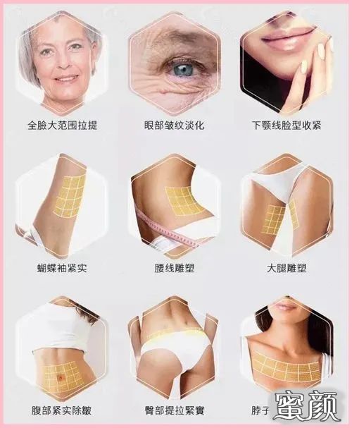 https://img.miyanlife.com/mnt/timg/211119/22502142O-3.jpg