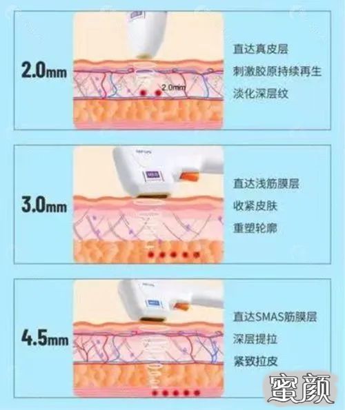 https://img.miyanlife.com/mnt/timg/211119/225021I51-2.jpg