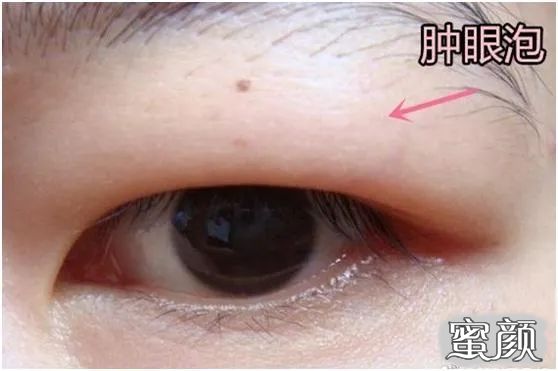 https://img.miyanlife.com/mnt/timg/211120/093620M96-2.jpg