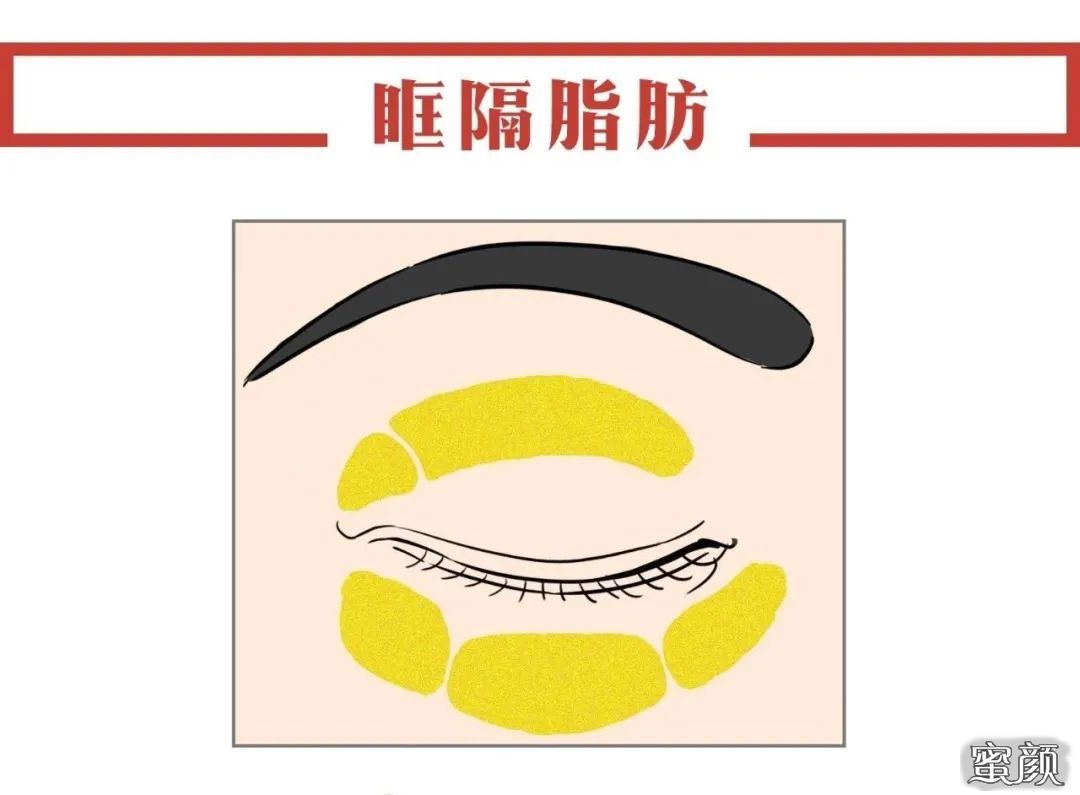 https://img.miyanlife.com/mnt/timg/211120/0936222Z2-7.jpg