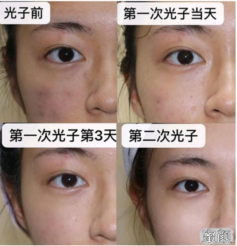 https://img.miyanlife.com/mnt/timg/211125/142QB3F-4.jpg