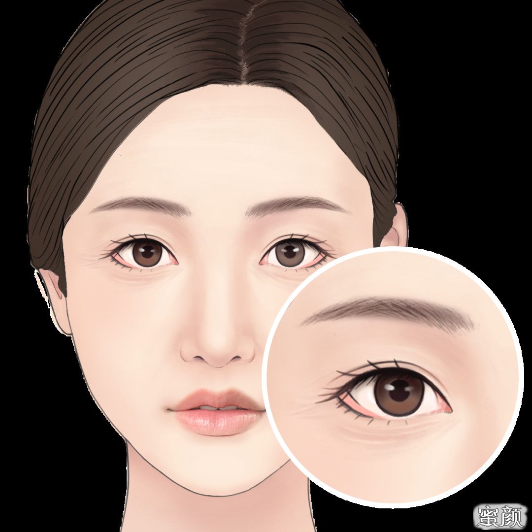 https://img.miyanlife.com/mnt/timg/211203/23504BR1-0.jpg