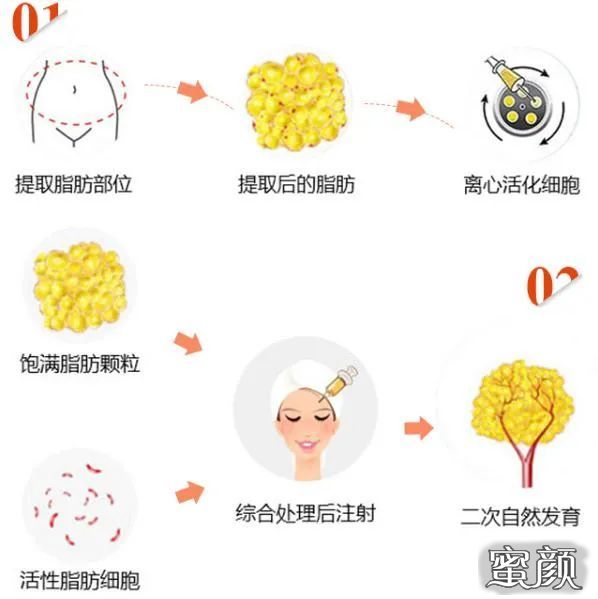 https://img.miyanlife.com/mnt/timg/211206/0T4162Y8-7.jpg