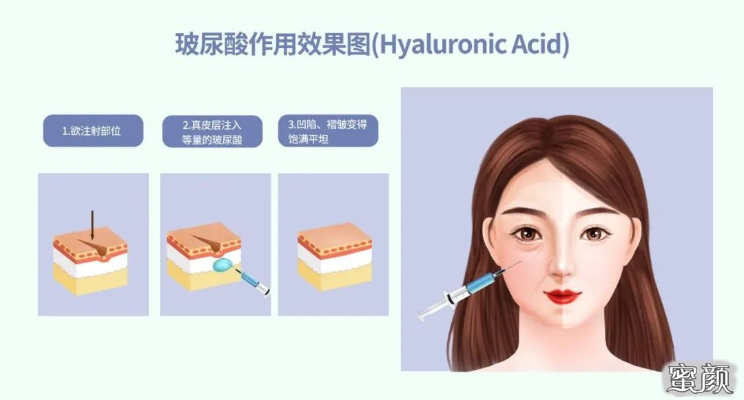 https://img.miyanlife.com/mnt/timg/211223/20254R494-5.jpg