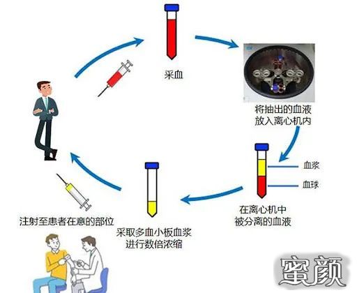 https://img.miyanlife.com/mnt/timg/211226/102K1K19-0.jpg