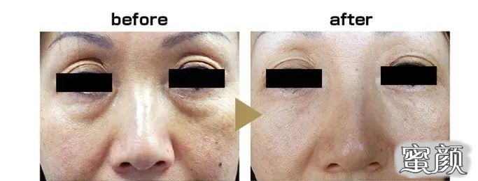 https://img.miyanlife.com/mnt/timg/211226/102K2H24-6.jpg