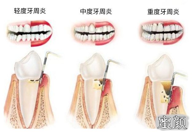 案例图片