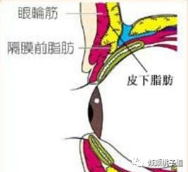 案例图片