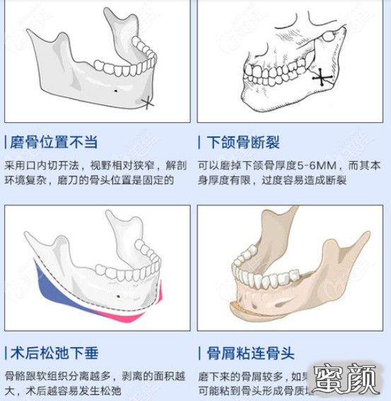 案例图片