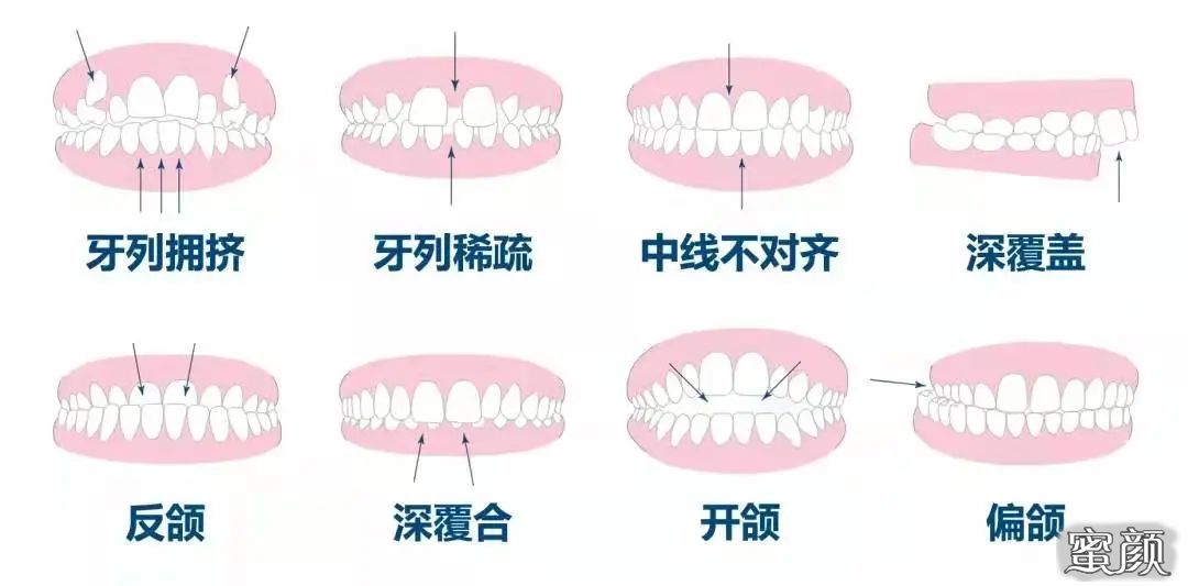 案例图片