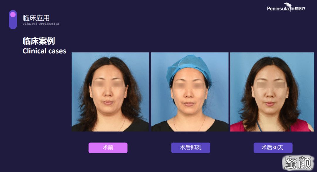 https://img.miyanlife.com/mnt/timg/220106/1129131Y9-6.jpg