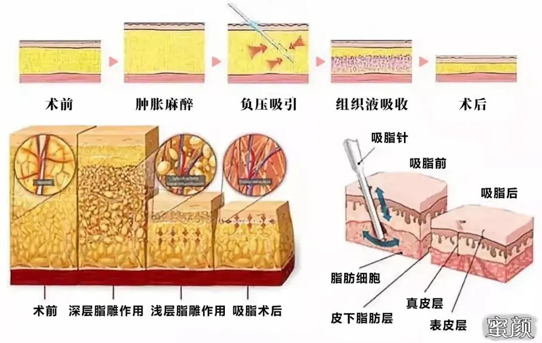 案例图片