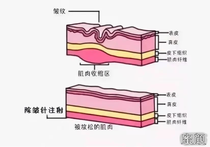 案例图片