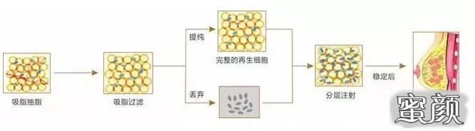 案例图片