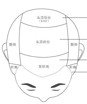 案例图片