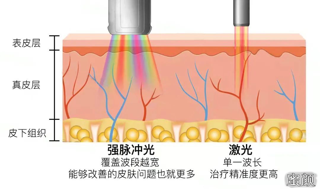 案例图片