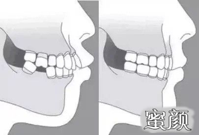 案例图片