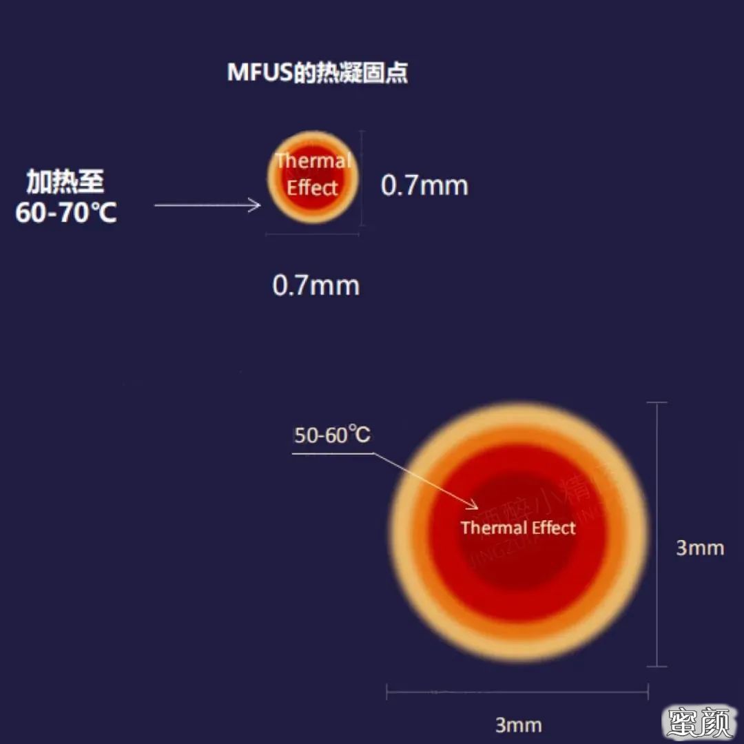 案例图片