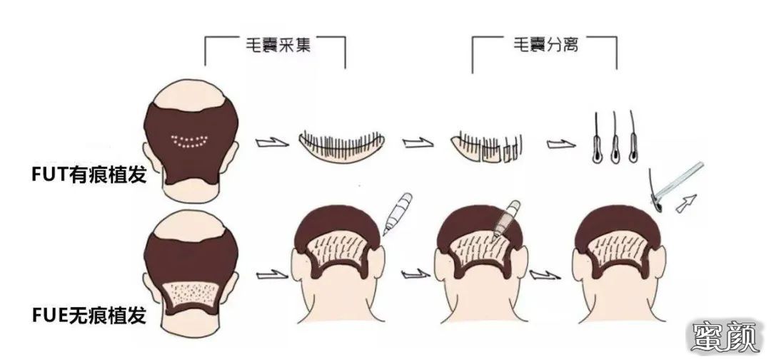 案例图片