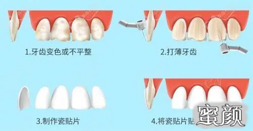 案例图片