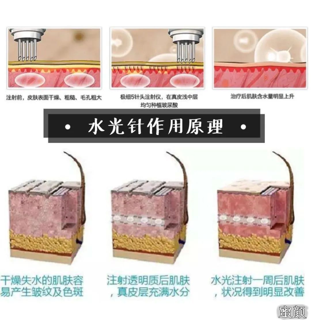 https://img.miyanlife.com/mnt/timg/220522/00153S103-0.jpg