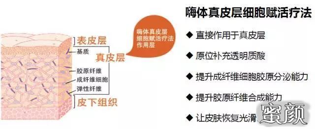 https://img.miyanlife.com/mnt/timg/220528/1A0442S0-2.jpg