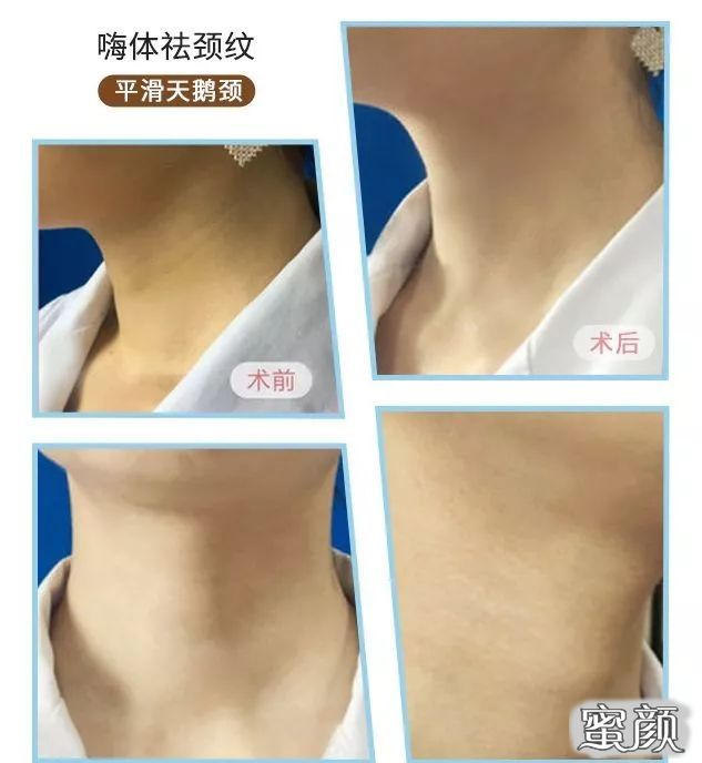 https://img.miyanlife.com/mnt/timg/220528/1A0445257-4.jpg