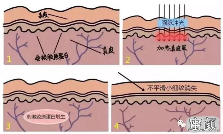 案例图片