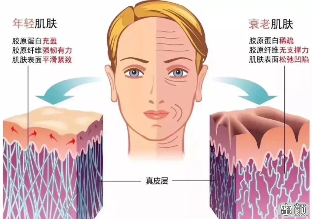 https://img.miyanlife.com/mnt/timg/220602/222T1I34-0.jpg