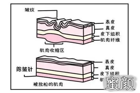 https://img.miyanlife.com/mnt/timg/220602/222TSI4-3.jpg