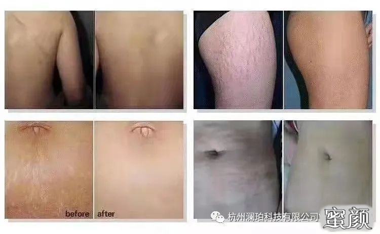 https://img.miyanlife.com/mnt/timg/220607/1F524H16-3.jpg