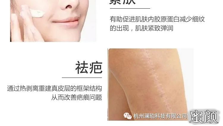 https://img.miyanlife.com/mnt/timg/220607/1F524O17-2.jpg