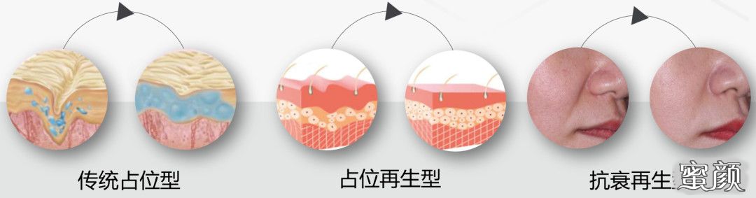 https://img.miyanlife.com/mnt/timg/220610/064J44Y1-4.jpg