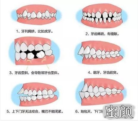 案例图片