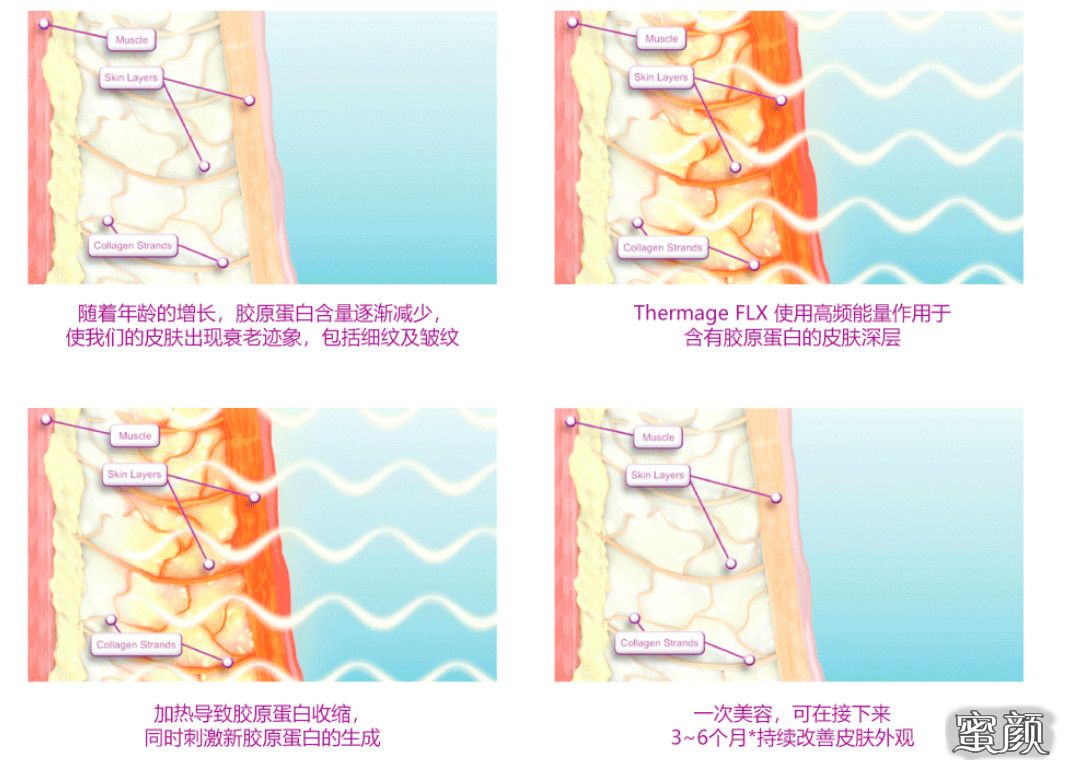 https://img.miyanlife.com/mnt/timg/220624/2306362959-1.jpg