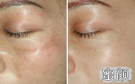 https://img.miyanlife.com/mnt/timg/220626/20512S508-2.jpg