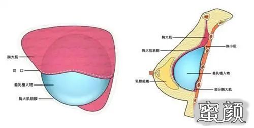 案例图片