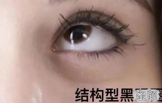 https://img.miyanlife.com/mnt/timg/220717/2215314495-3.jpg