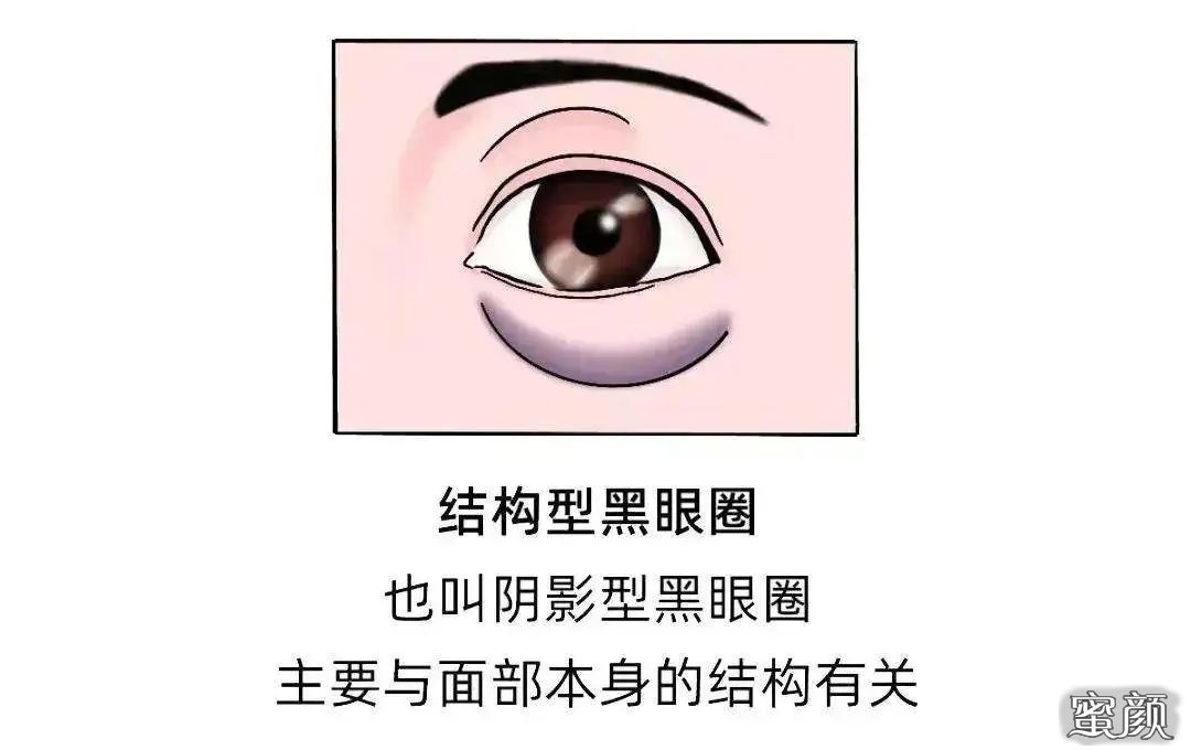 https://img.miyanlife.com/mnt/timg/220717/2215314T5-4.jpg