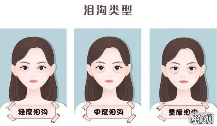 https://img.miyanlife.com/mnt/timg/220717/2215324D3-5.jpg