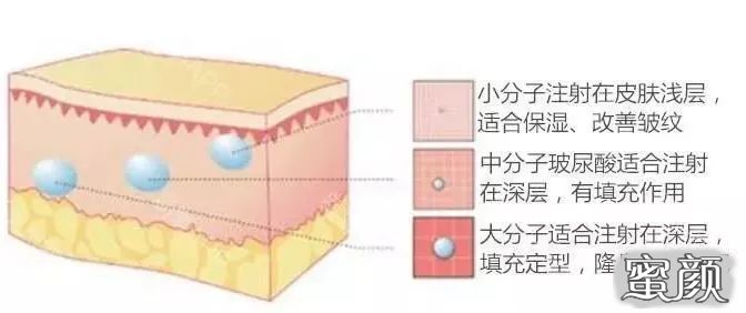 https://img.miyanlife.com/mnt/timg/220807/13444AW9-0.jpg