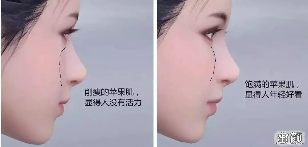 https://img.miyanlife.com/mnt/timg/220807/1344534015-2.jpg