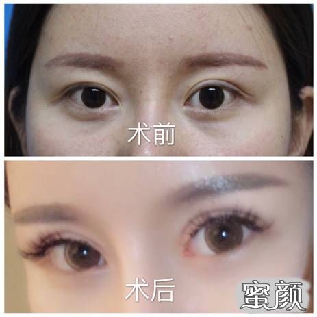 https://img.miyanlife.com/mnt/timg/220823/1549331244-1.jpg