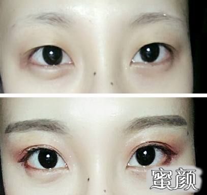 https://img.miyanlife.com/mnt/timg/220823/15493335a-0.jpg