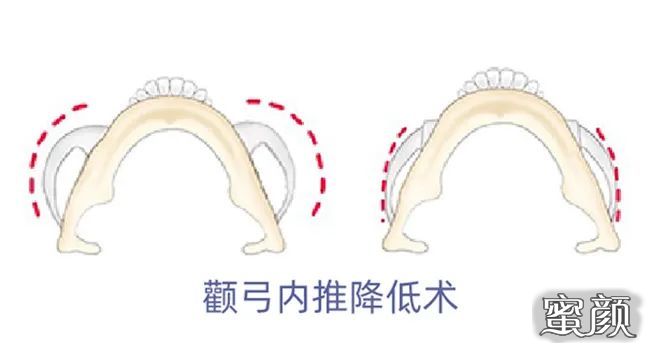 案例图片