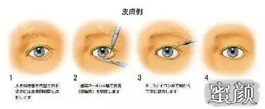 https://img.miyanlife.com/mnt/timg/221010/201353G93-2.jpg