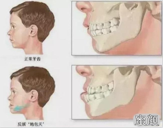 案例图片