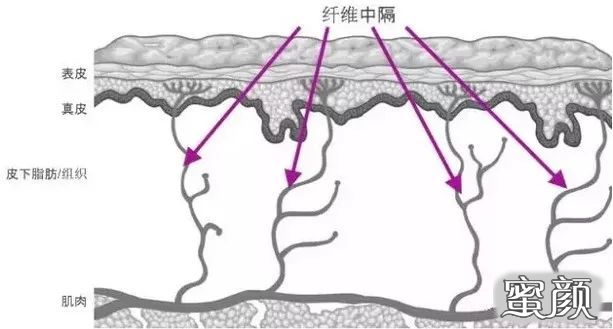 案例图片