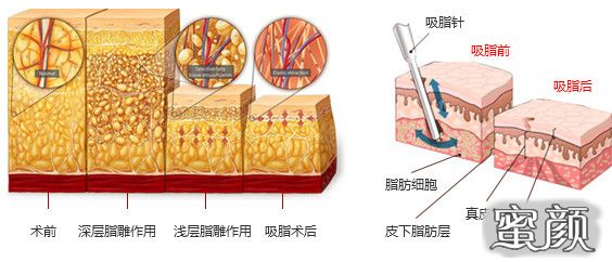 案例图片