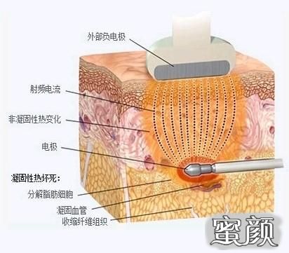 案例图片